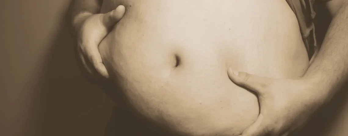 İnsanoğlu Obezite İle Ringte