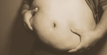 İnsanoğlu Obezite İle Ringte